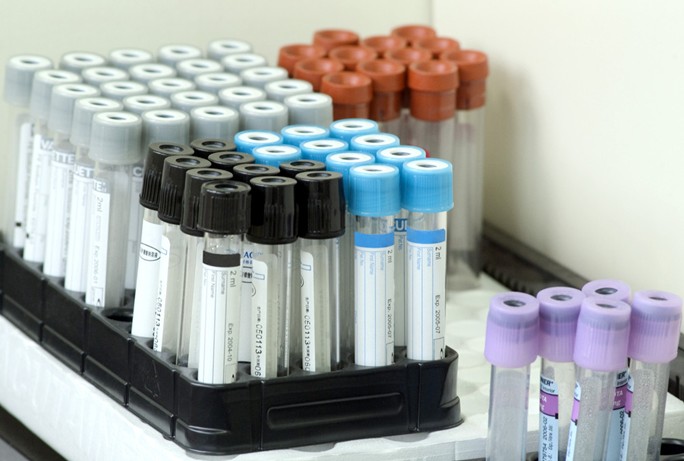 不打自己商標(biāo)的醫(yī)療器械廠商是否需要申請CE認(rèn)證標(biāo)志